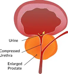 prostanu prostate support illustration 1